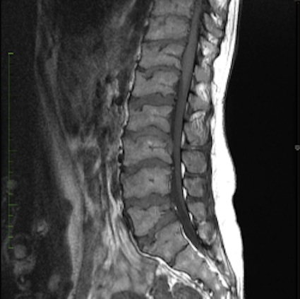 Figure 3 for case Kneist dysplasia